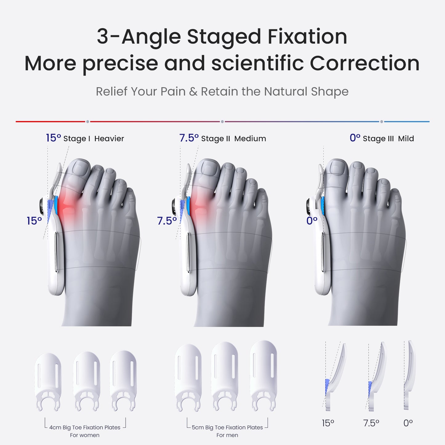 SissAlign™  Bunion Corrector