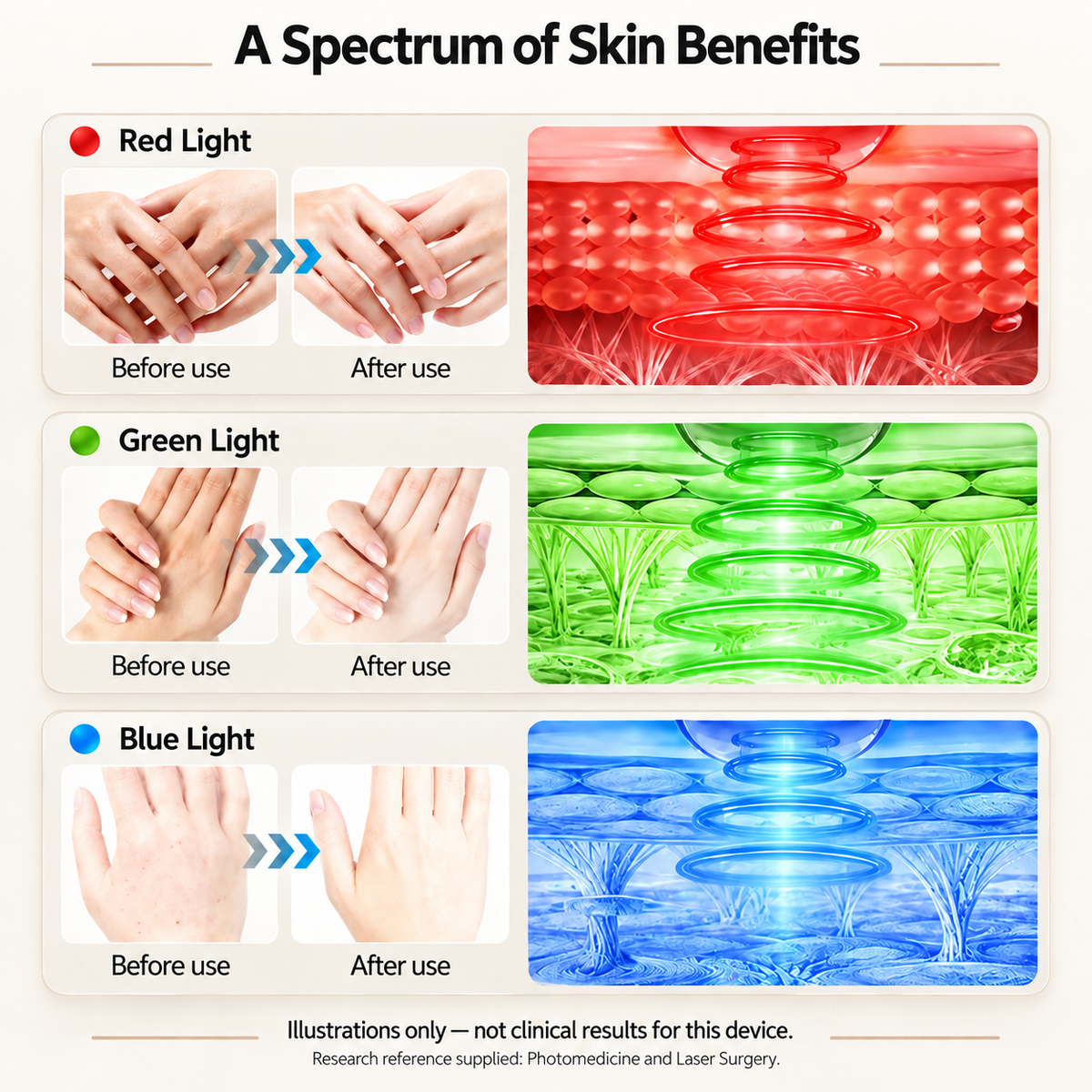 SissGlove™ Elite Hand Massager with Light Therapy